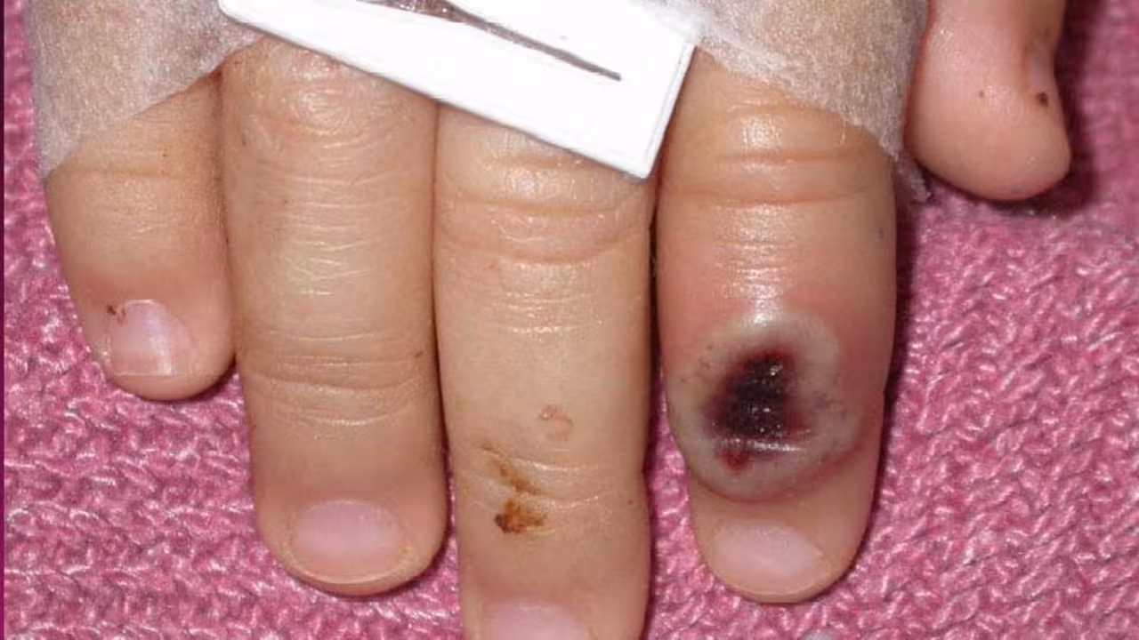 EFE/Cortes&iacute;a CDC